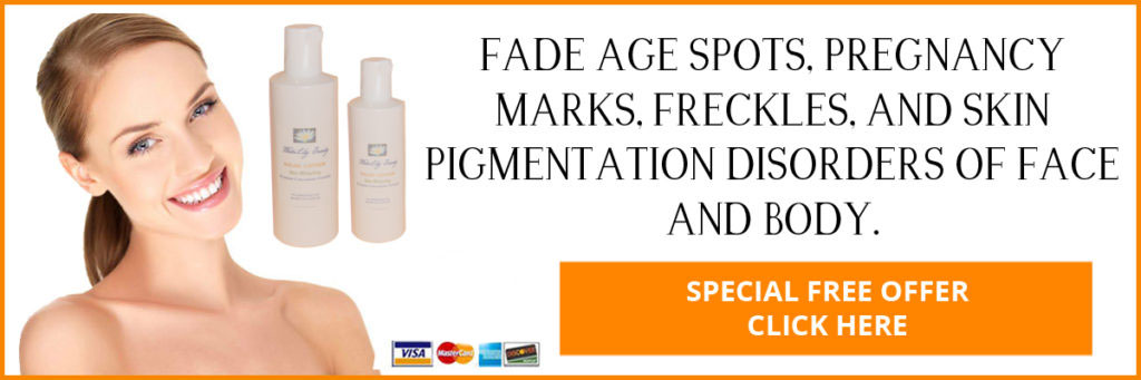 Fade Age Spots, Pregnancy Marks, Freckles, and Skin Pigmentation Disorders of Face and Body.